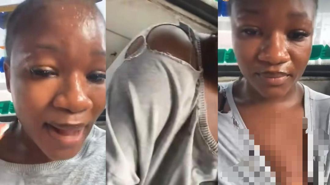 “This Feels Unreal!” – Lady Horrified After Alleged Mad Man Bites Her on Lagos Bus