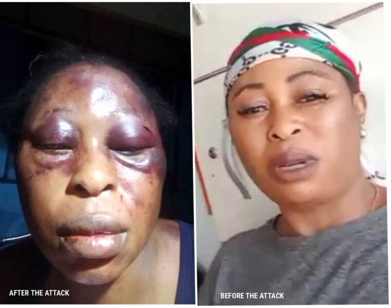 Mother of Three Beaten by Neighbours Over Prepaid Meter’s Recharge (PHOTOS)