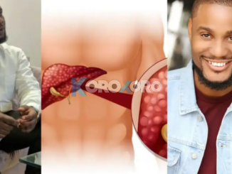 Alexx Ekubo’s death: Medical doctor lists 7 ways to protect oneself from liver cancer in 2026
